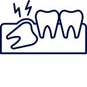 Wisdom tooth removal