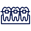 orthodontic treatment