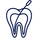 root-canal